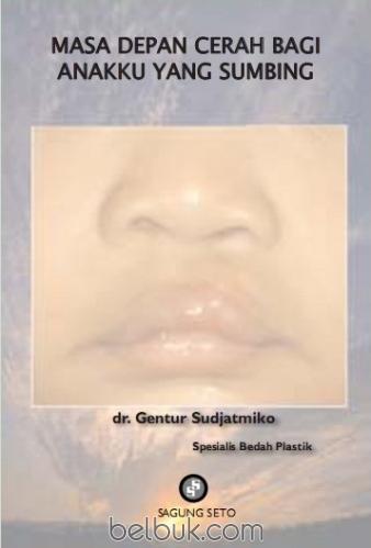 Cover Masa depan cerah bagi anakku yang sumbing / Gentur Sudjatmiko