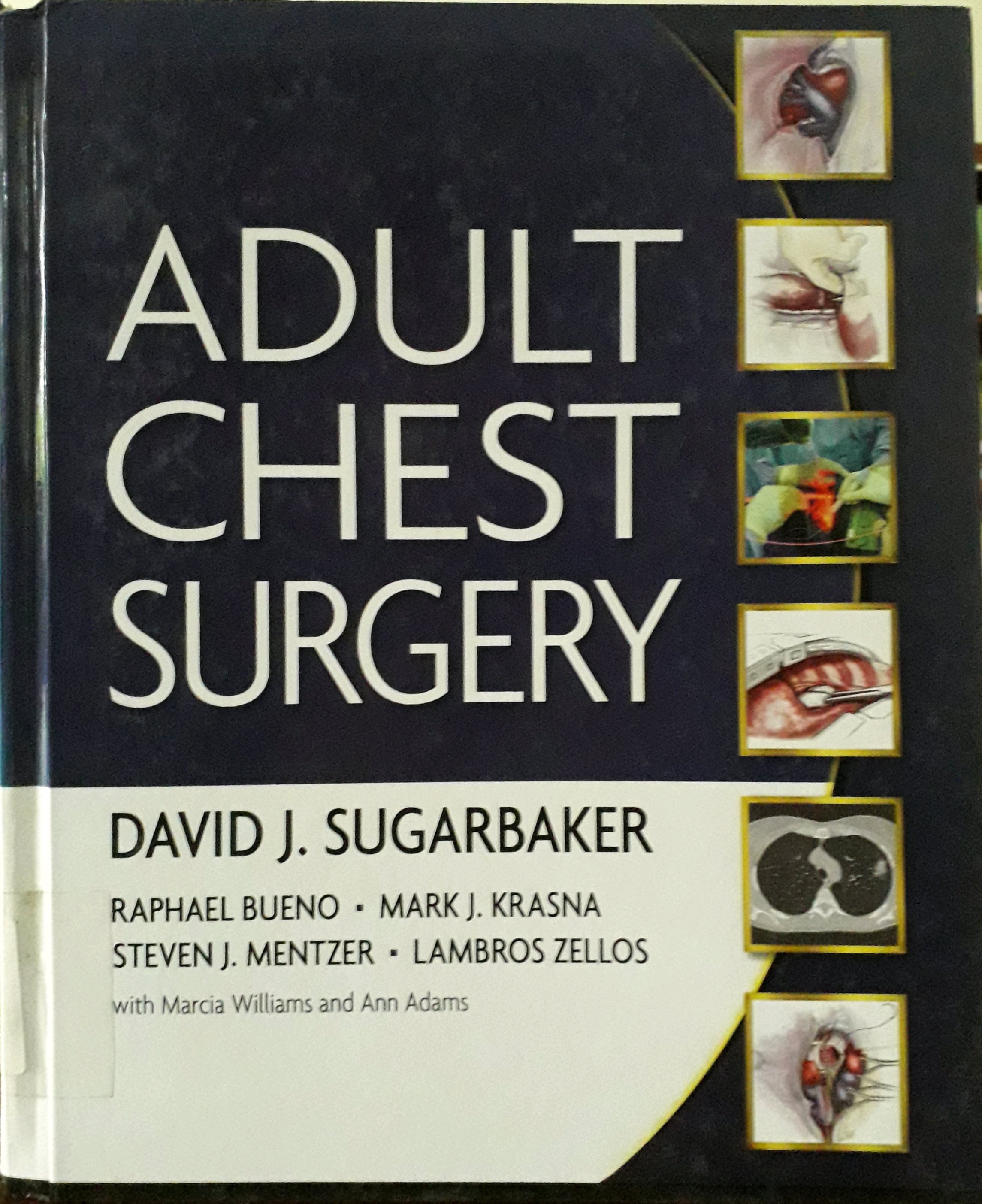 Cover Adult Chest Surgery / Penulis, David J. Sugarbaker